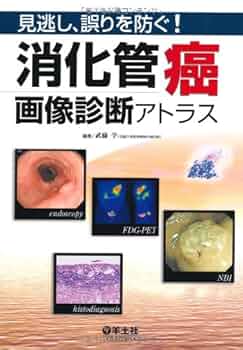 消化器画像診断アトラス 消化器画像診断アトラス | 徹, 下瀬川, 智幸, 小池, 克哉, 遠藤